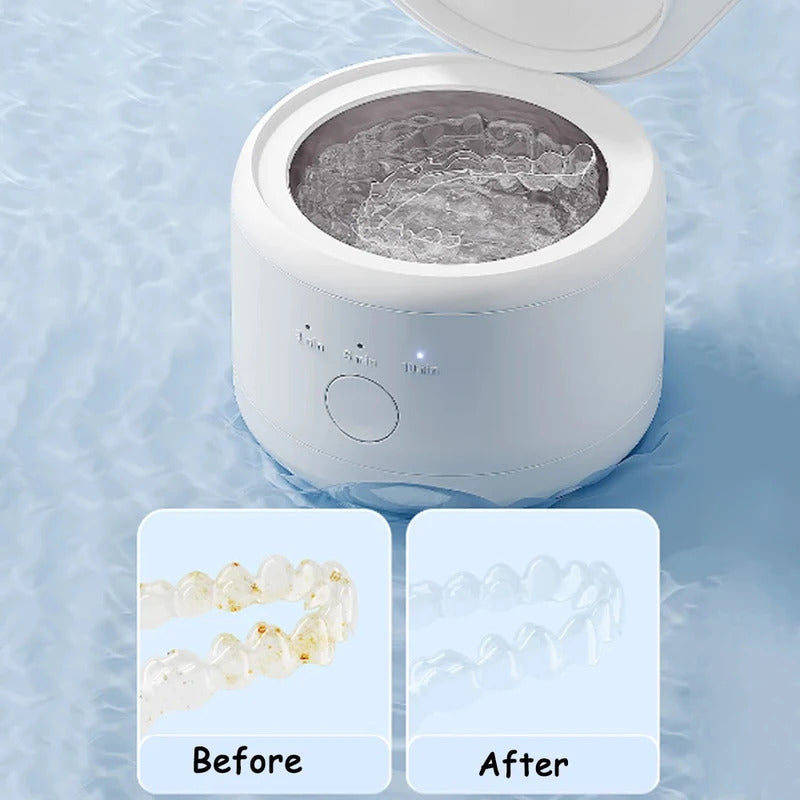 15W Ultrasonic Cleaner for Dentures Professional Ultrasonic Cleaning Machine for Dental Jewelry Watch Eye Glasse Makeup Brush