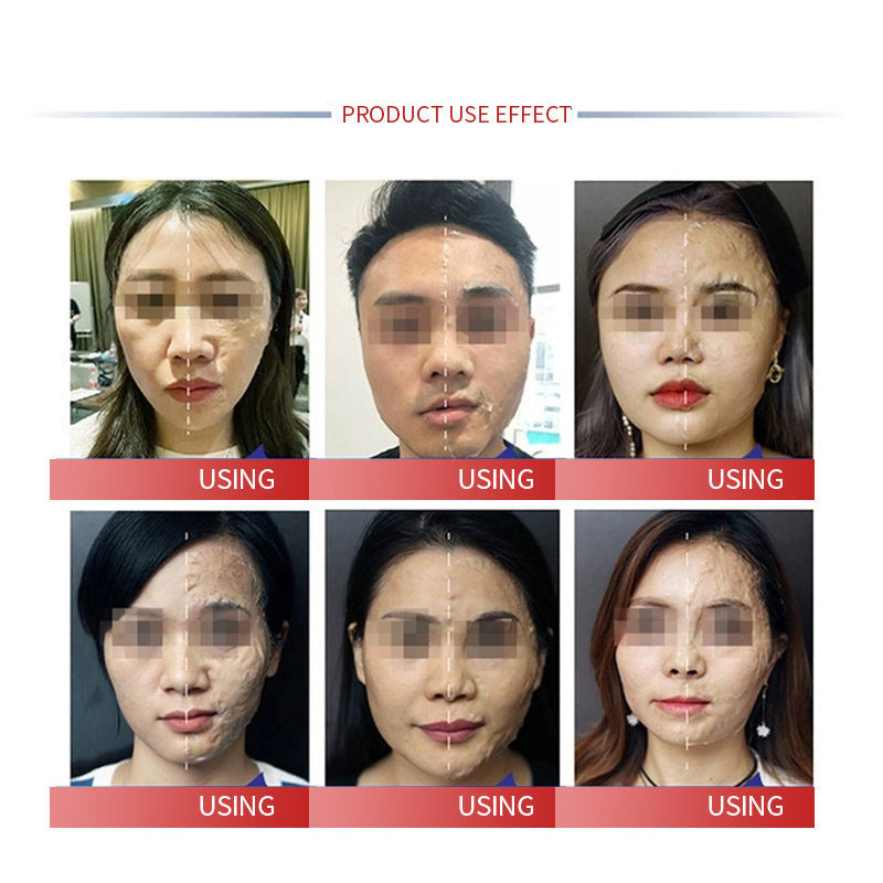 Wholesale Witch Mask Enzyme Brush for Lifting, Firming, Anti-Wrinkle, Nasolabial Folds, Beauty Salon Application Mask Enzyme Brush Set